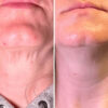REVOX™ Lifting Neck Cream