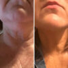 REVOX™ Lifting Neck Cream