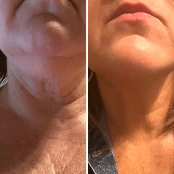 REVOX™ Lifting Neck Cream