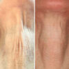REVOX™ Lifting Neck Cream