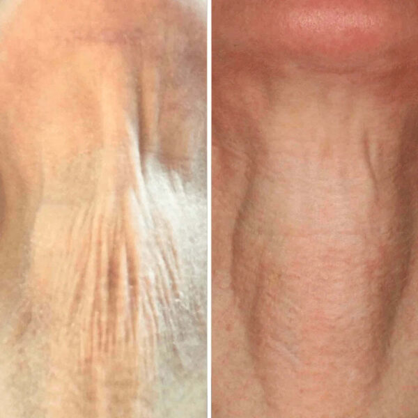 REVOX™ Lifting Neck Cream