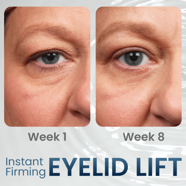 REVOX™ OpenEye – Peptide Firming Eye Gel
