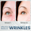 REVOX™ OpenEye – Peptide Firming Eye Gel