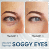 REVOX™ OpenEye – Peptide Firming Eye Gel