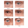 REVOX™ BrightUp - Eliminates eye bags & wrinkles