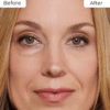 REVOX™ BrightUp - Eliminates eye bags & wrinkles