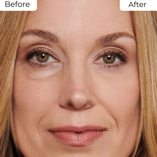 REVOX™ BrightUp - Eliminates eye bags & wrinkles