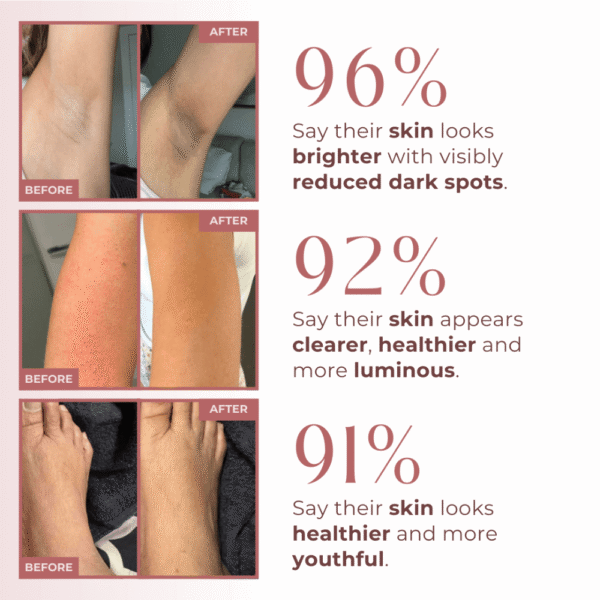 Body Peel Spray - Kojic + Turmeric