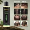 Revox™ Rosemary Shampoo – Reduce Breakage & Boost Volume