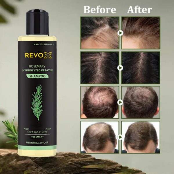 Revox™ Rosemary Shampoo – Reduce Breakage & Boost Volume