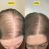 Revox™ Rosemary Shampoo – Reduce Breakage & Boost Volume