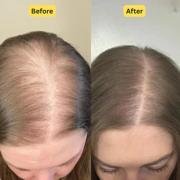 Revox™ Rosemary Shampoo – Reduce Breakage & Boost Volume