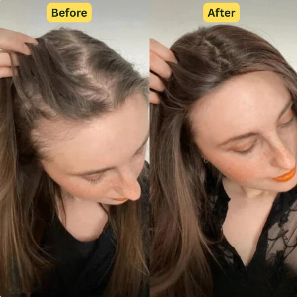 Revox™ Rosemary Shampoo – Reduce Breakage & Boost Volume