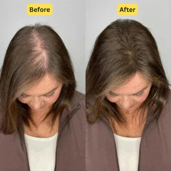 Revox™ Rosemary Shampoo – Reduce Breakage & Boost Volume