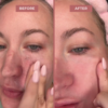 Rice Peel Shot Ampoule™