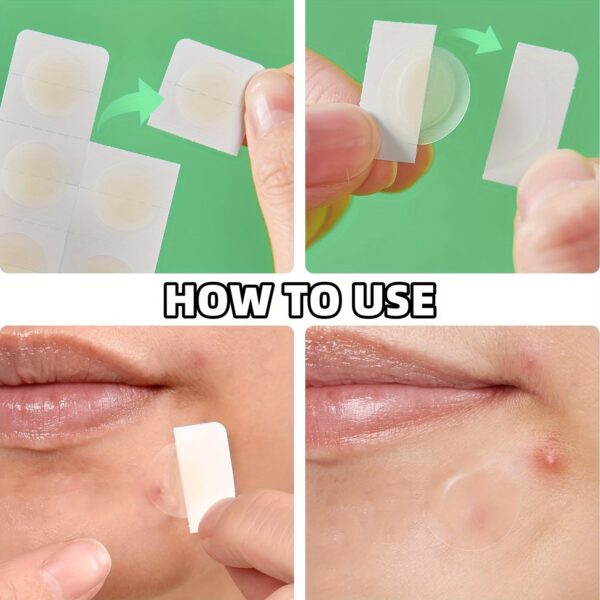 Revox™ Blemish Shields
