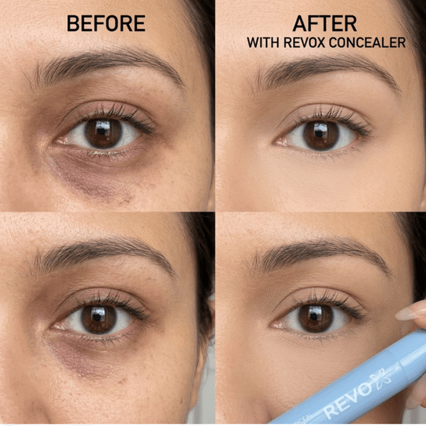 4 (7) REVOX™ Piple Consealer