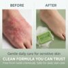 REVOX™ Antifungal Soap
