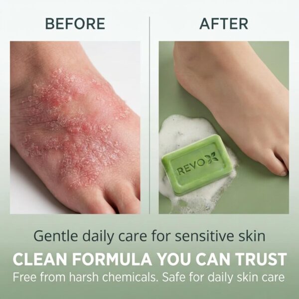 REVOX™ Antifungal Soap